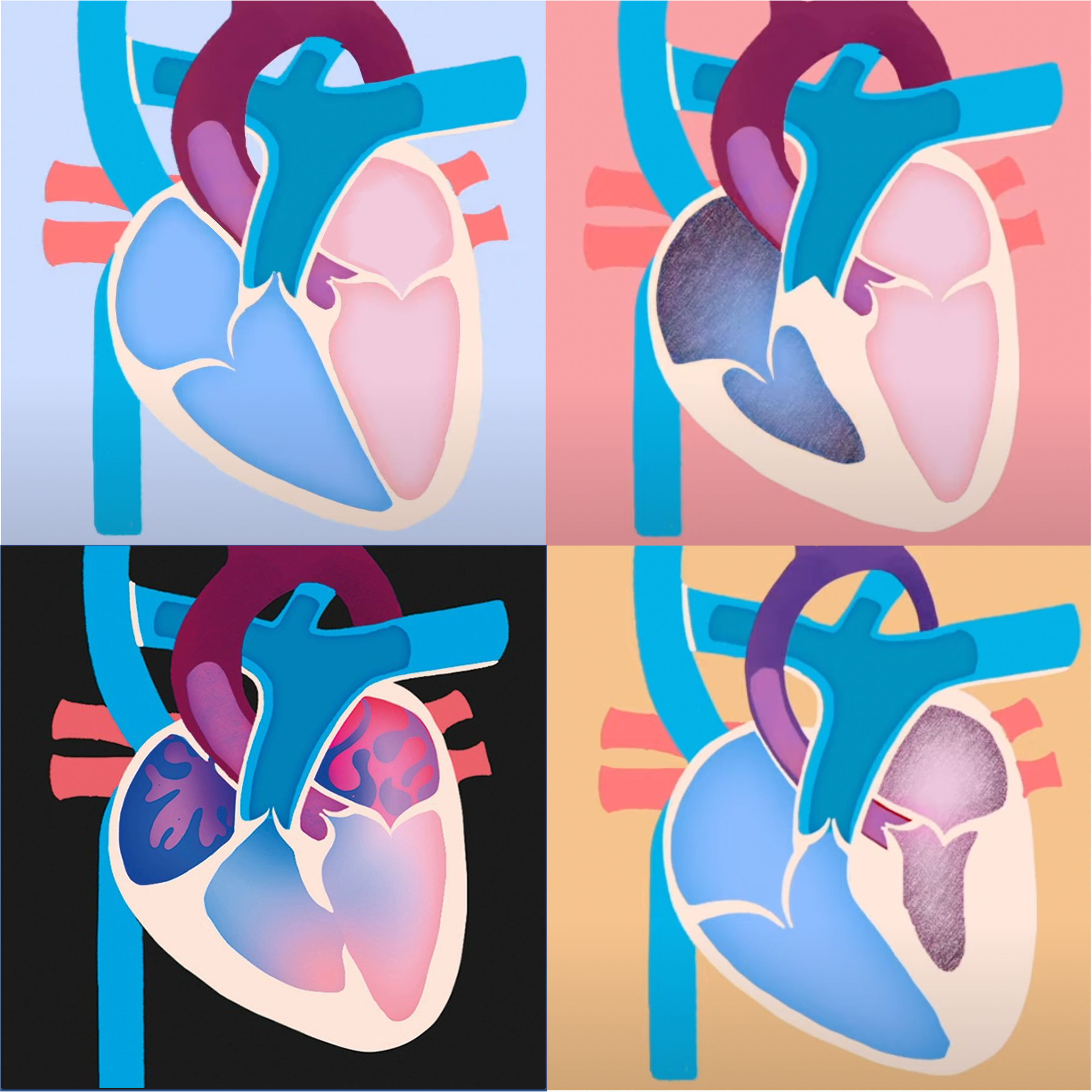 Open Call: Single Ventricle Research Fund
